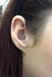 Daith heart